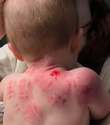 Outraged Family Sues Dickinson Daycare — Shocking Details Emerge Outraged Family Sues Dickinson Daycare — Shocking Details Emerge