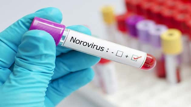 012619_istockphoto_norovirus