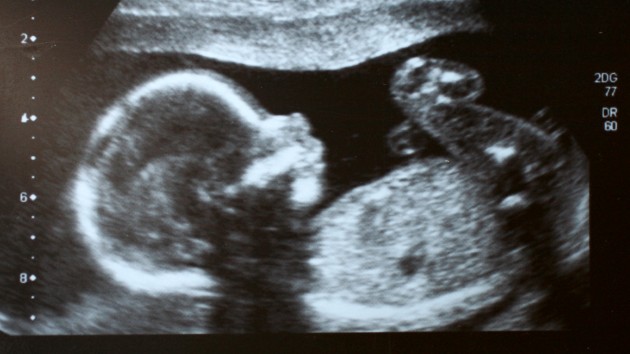 istock_32219_ultrasound