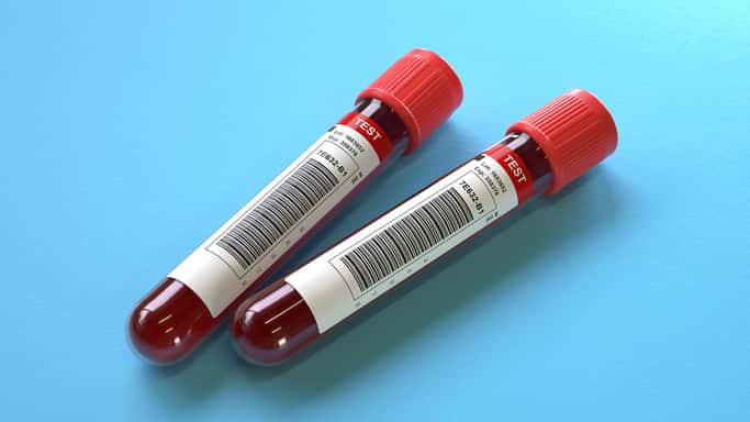 istock_072519_bloodtest