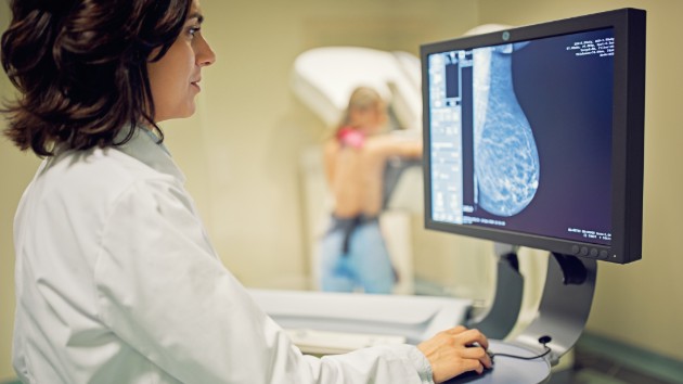 istock_82119_breastscreening
