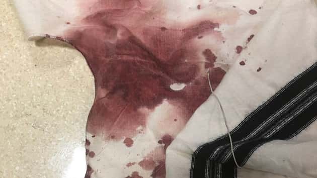 brooklyn-attack-bloody-shirt-ht-jc-190827_hpmain_4x3_992