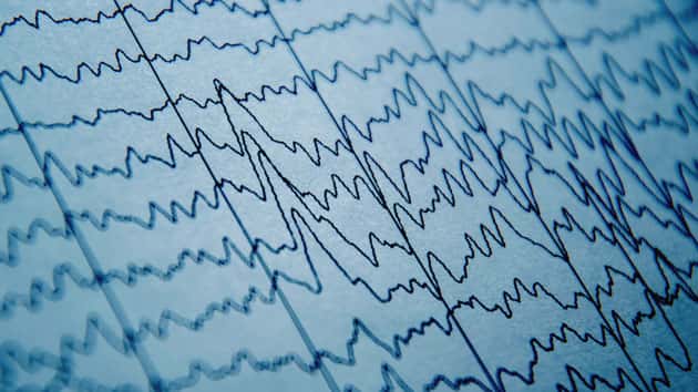 istock_brainwaves_100419