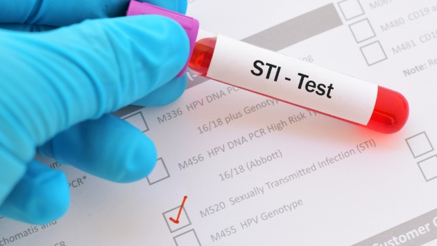 istock_101119_stdtest