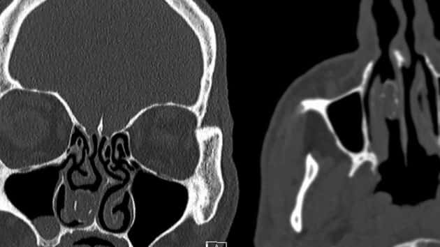 pot-nose-ht-jt-191104_hpmain_4x3_992