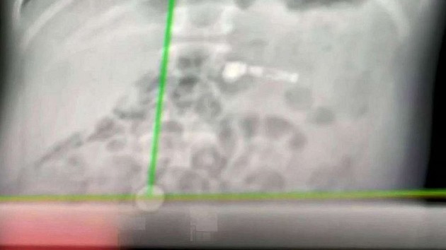 airpod-xray-ht-ps-200101_hpmain_16x9_992201