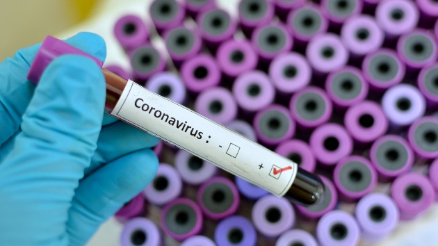 istock_12820_coronaviruspositive-2