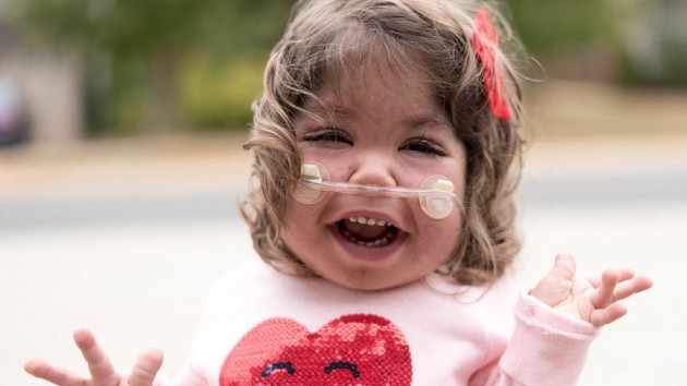 toddler-rare-disorder-3d-printed-oxygen-tank-holders_ht_main_np-200204_hpmain_16x9_992201