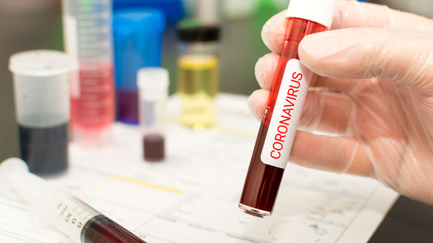 istock_coronavirus_021120