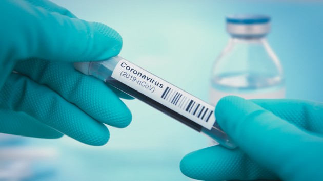 istock_3420_covidtesttube