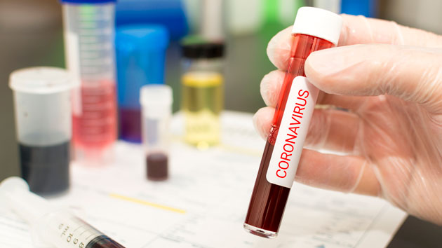 istock_coronavirus_0304210