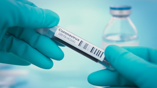 istock_3920_covid19tube