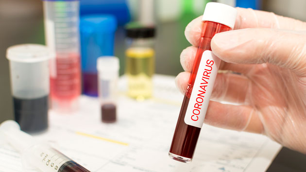 istock_coronavirus_031020