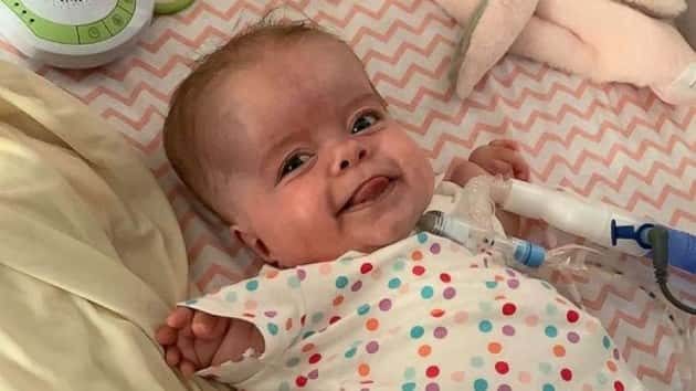 baby-rare-dwarfism-home-184-days-hospital-ht-07-np-200317_hpmain_16x9_992201