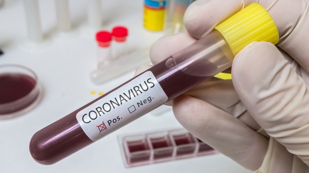 istock_41020_coronavirusposresult