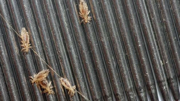 istock_41420_headlice