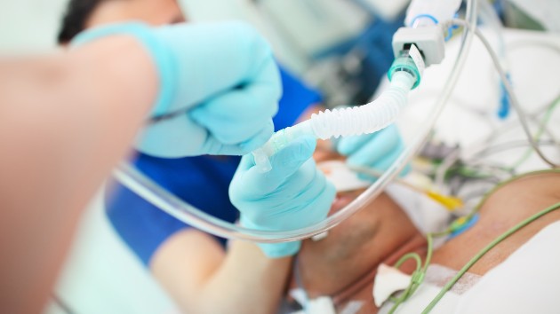 istock_41520_intubation