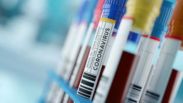 istock_042020_covidskinsymptom