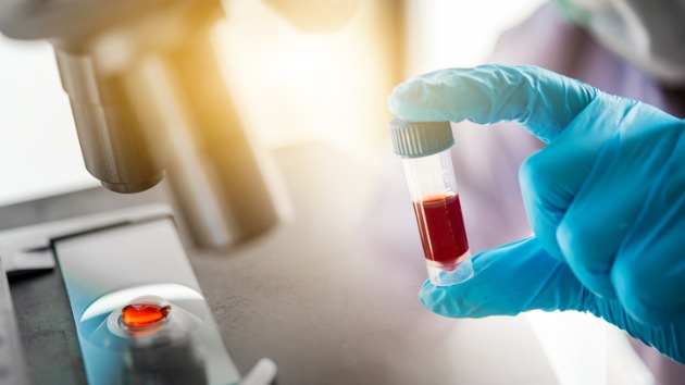 istock_antibodies_042320
