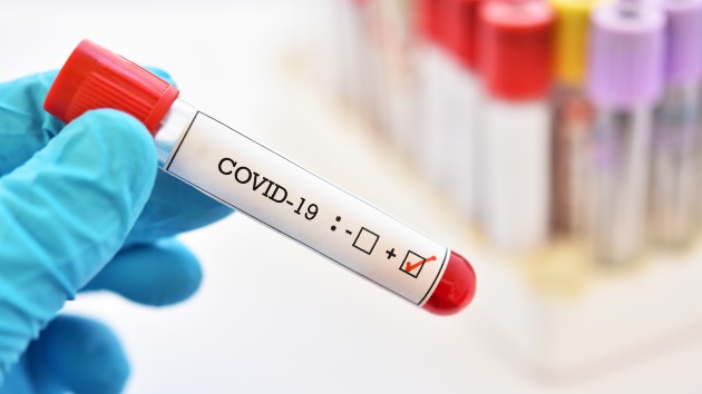 istock_42720_covidpos