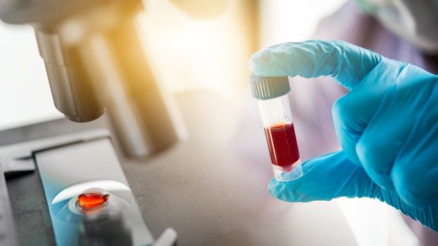 istock_42920_antibodytestlab