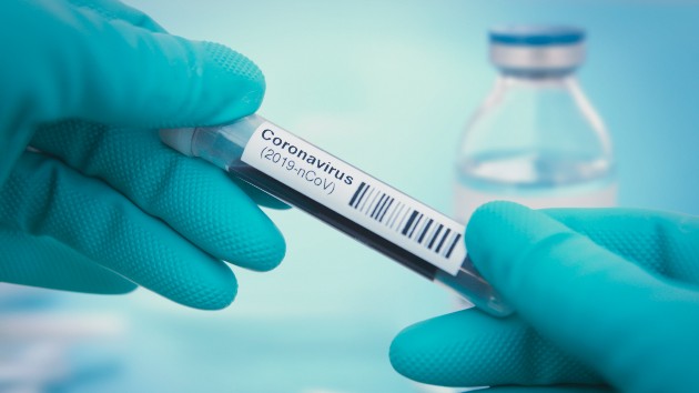 istock_5620_covidtesthands