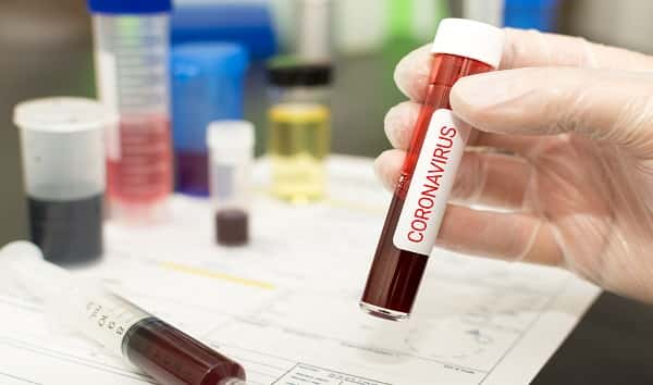 istock_022220_coronavirus_mrtom-uk-22