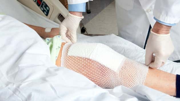 istock_61120_kneereplacement