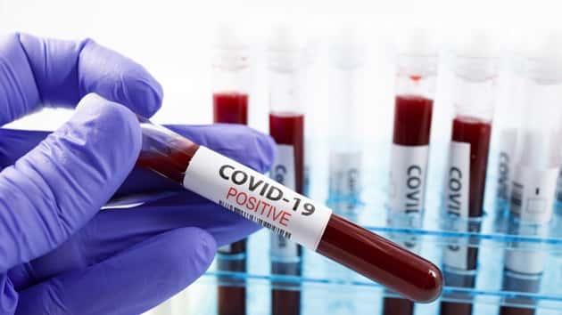 istock_071720_covidupdates