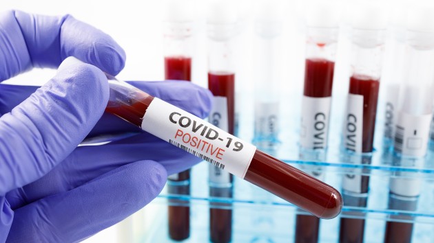 istock_72420_covidpositivetest