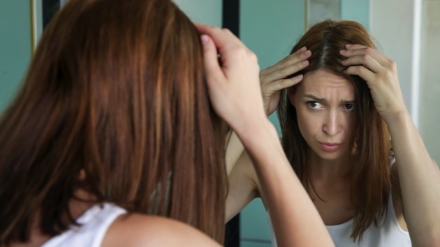 istock_081120_hairloss