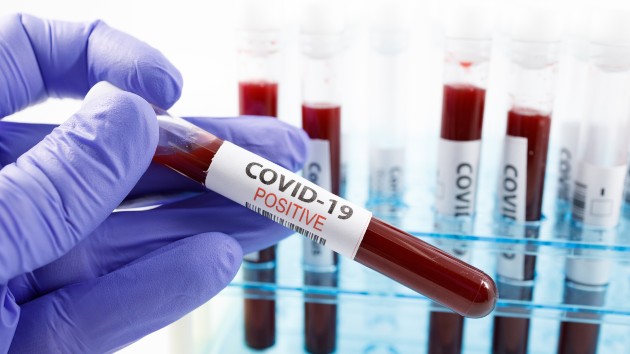 istock_81320_covidbloodsample