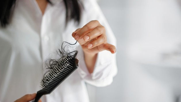 istock_82120_hairlosswoman