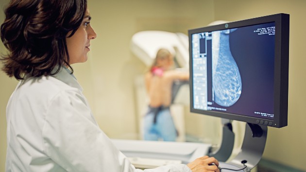 istock_82820_mammogram
