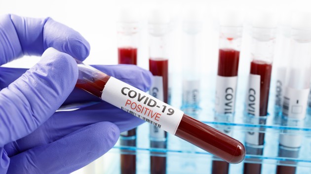 istock_92520_covidpossample
