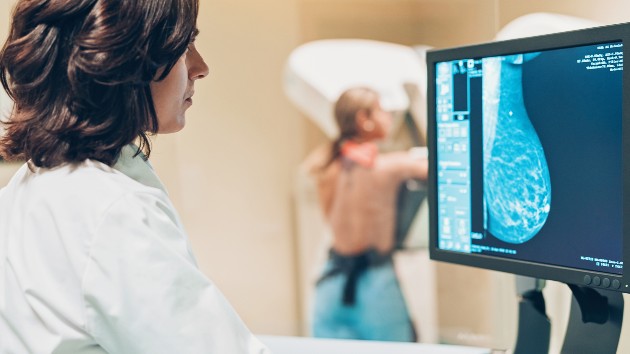 istock_10120_mammogram