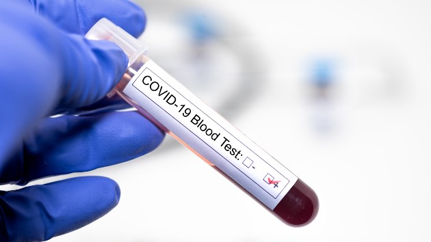 istock_111220_covidbloodtestpost