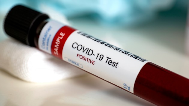 istock_112720_covidbloodsample