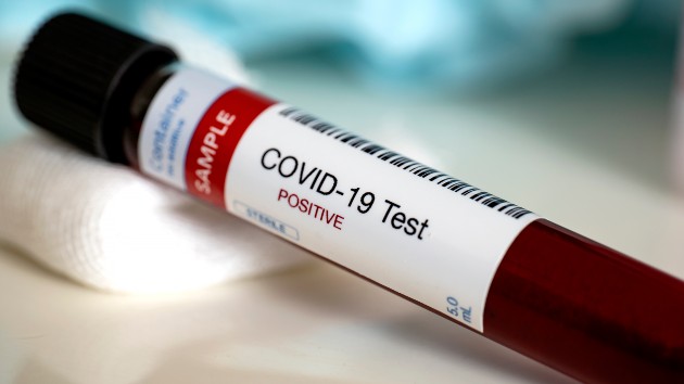 istock_121420_covidtestblood