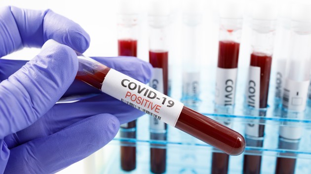 istock_1421_covidbloodsample
