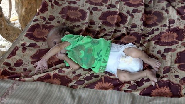 012421_abcnews_yemen
