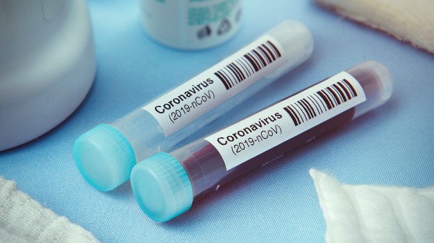 istock_2321_covidbloodtubes