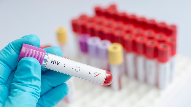 istock_31121_hivtesttubes