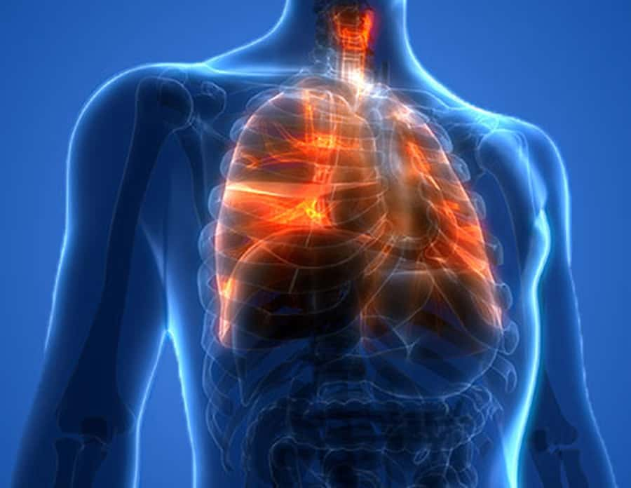 lung-injury-900xpx-cdc-jpg