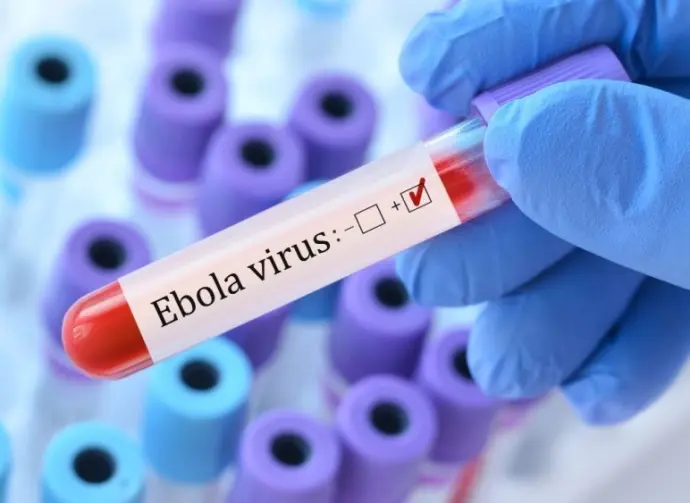 Doctor holding a test blood sample tube with Ebola virus test on the background of medical test tubes with analyzes.
