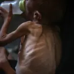 getty20gaza20hunger827924-150x150871560-1