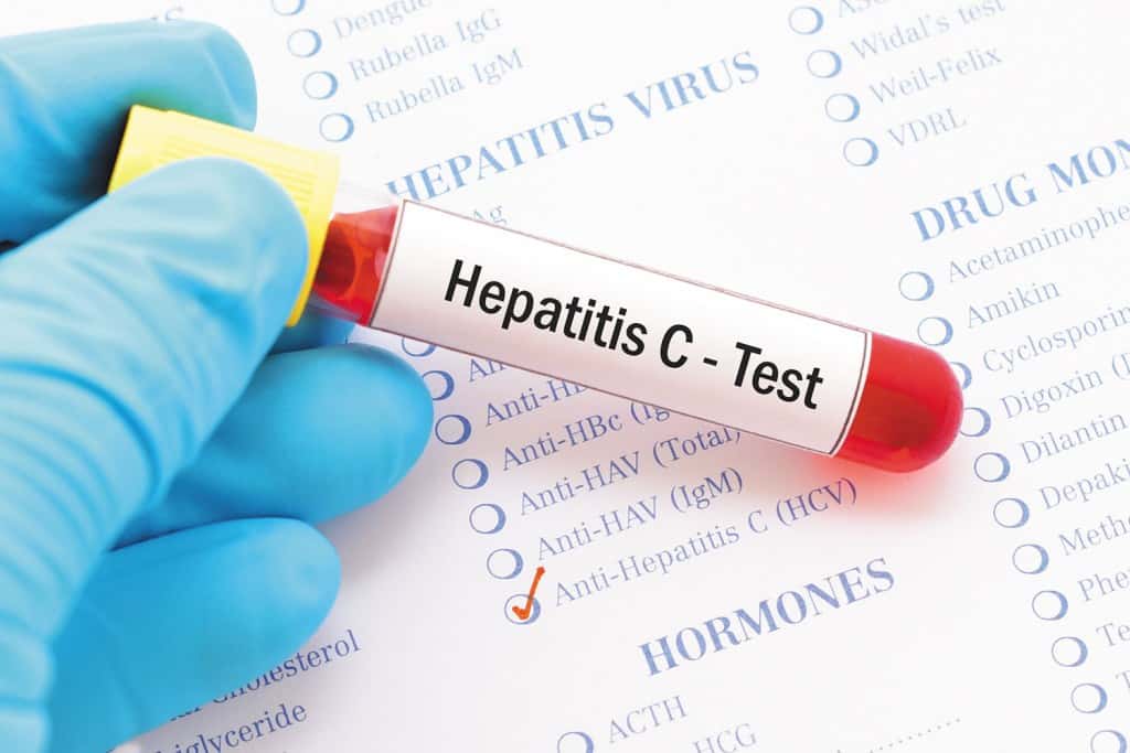 hep-c-stock