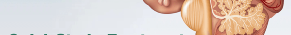stroke_brain-png