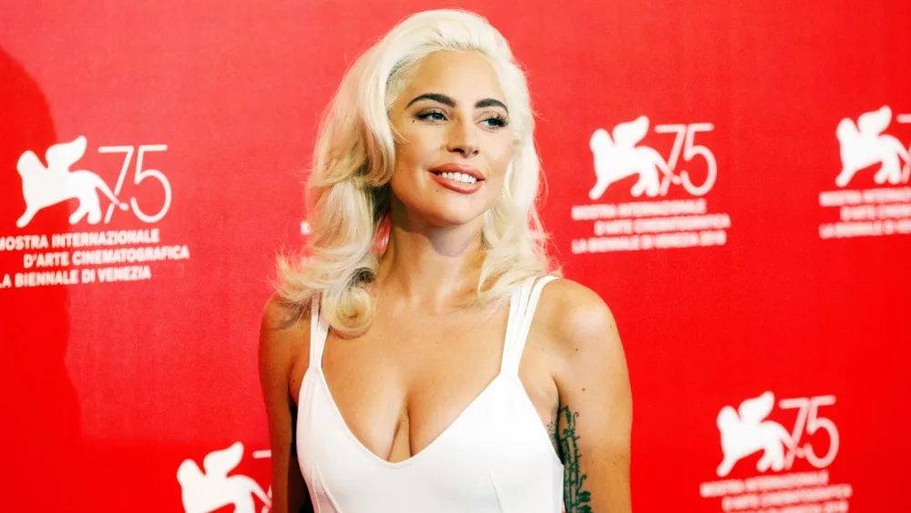 Lady Gaga attends the photo-call of the movie 'A Star Is Born' during the 75th Venice Film Festival on August 31, 2018 in Venice, Italy.