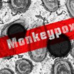 monkeypox-150x150-1-2